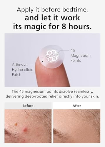 EasyDerm Microdart Pimple Patches with Cica Ampoule