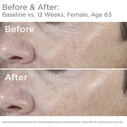 SkinMedica Facial Sunscreen Broad-Spectrum Protection, 2.3 oz