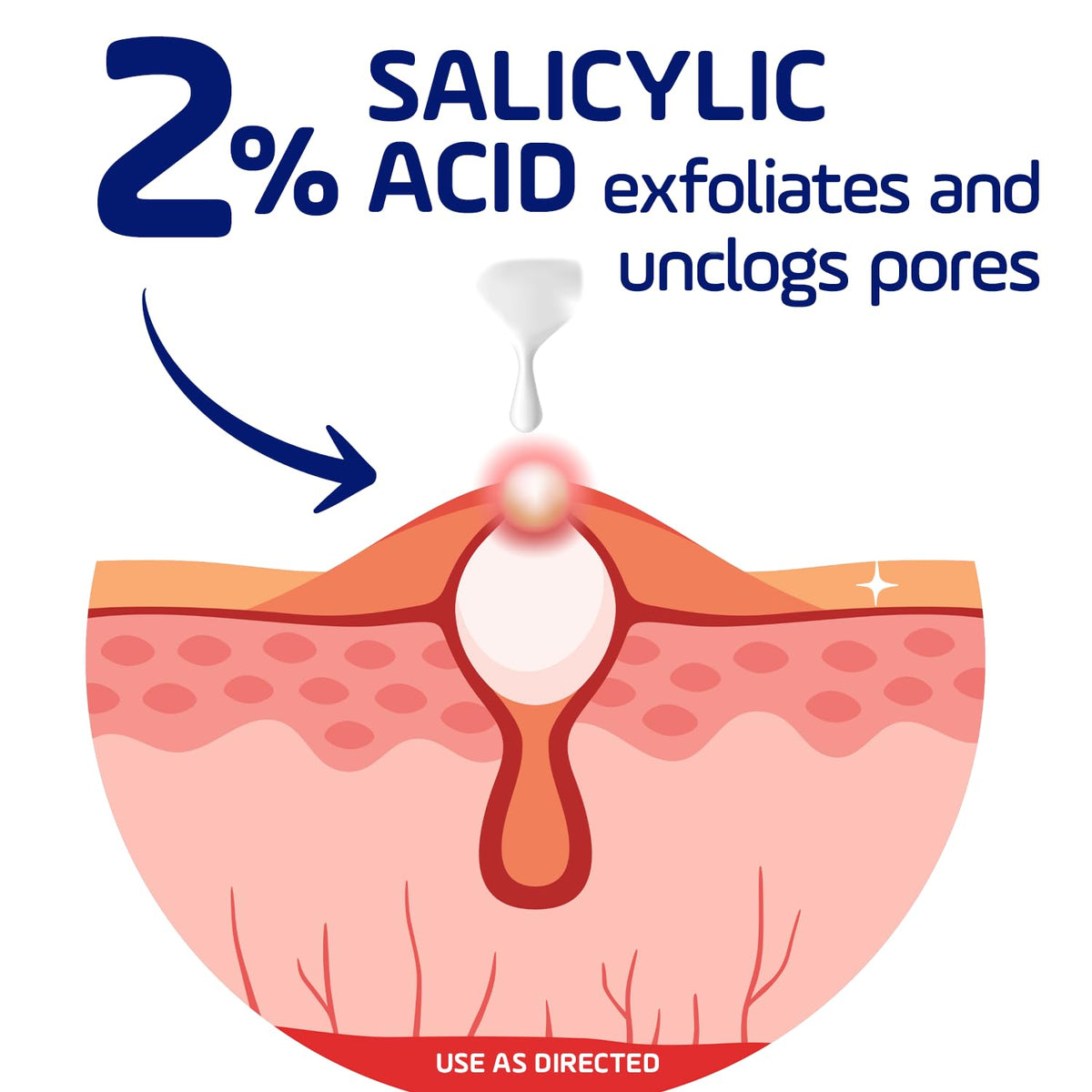 Asepxia 2% Salicylic Acid Acne Spot Treatment Cream