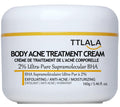TTLALA Body Acne Treatment Cream with 2% Salicylic Acid