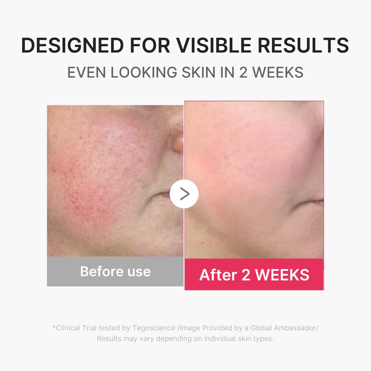 medicube Facial Skincare Tool