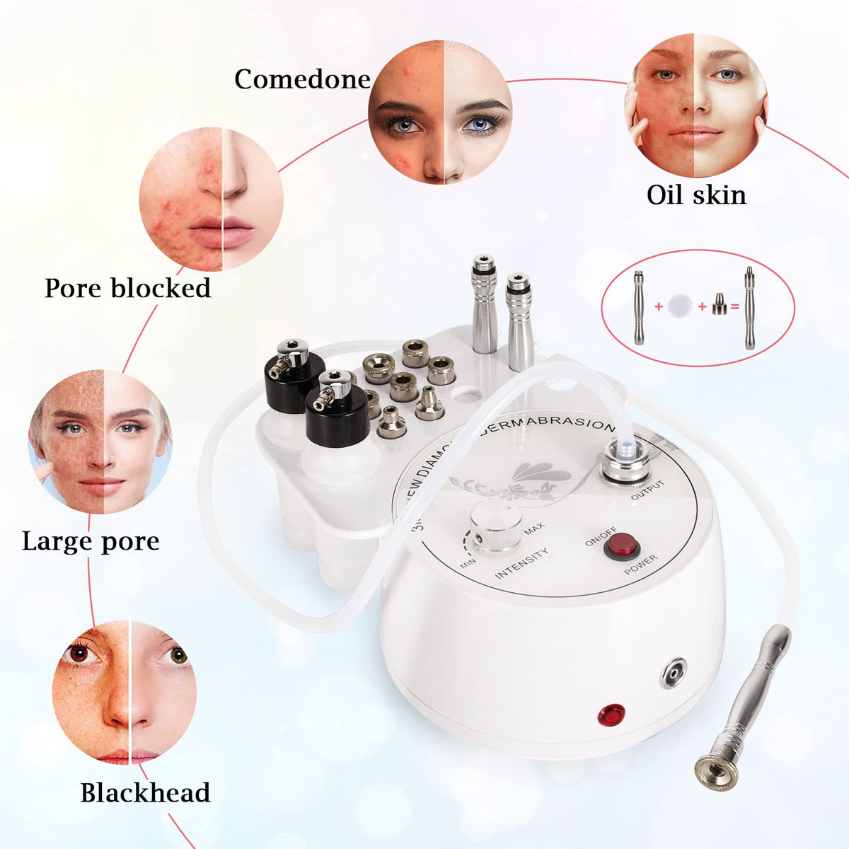 3-in-1 Diamond Microdermabrasion System with Adjustable Vacuum and Spray