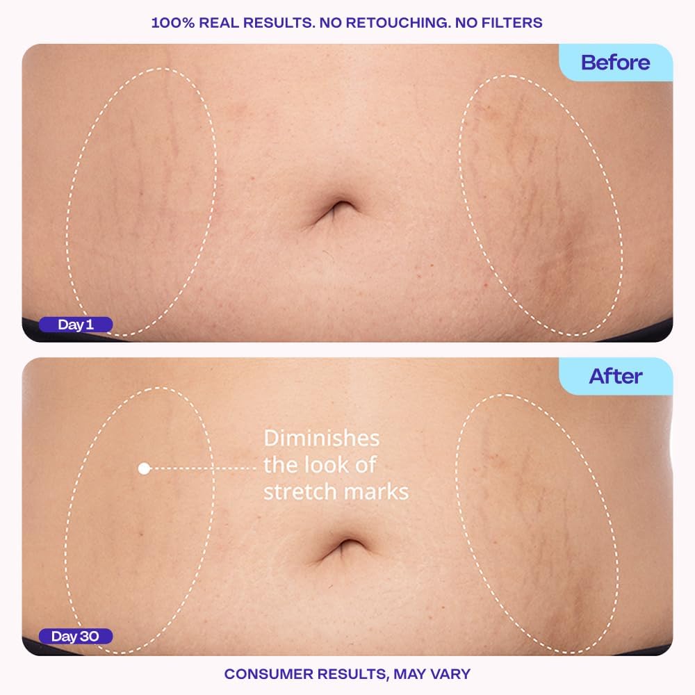 GOPURE Tighten & Smooth Belly Cream for Firmer-Looking Skin