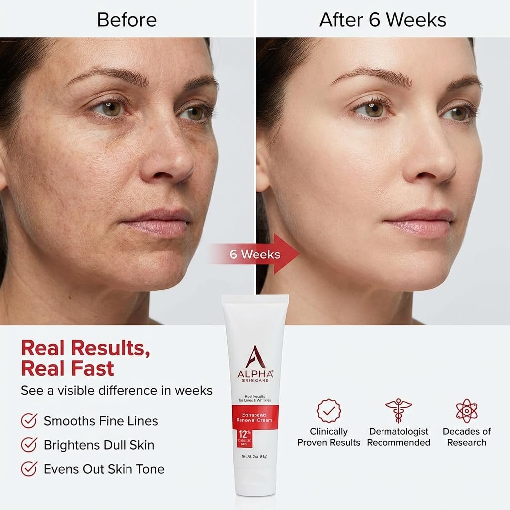 Alpha Skin Care Enhanced Renewal Cream with 12% Glycolic AHA