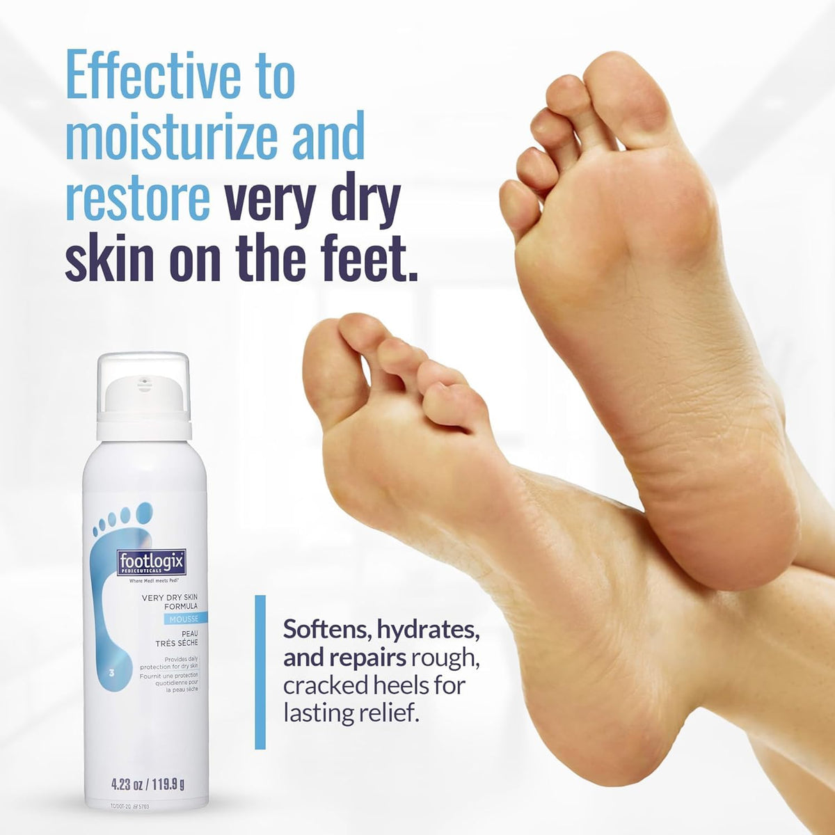 FOOTLOGIX Very Dry Skin Formula Foot Mousse with Urea, Co-Q10 & Aloe Vera, 4.23 fl oz