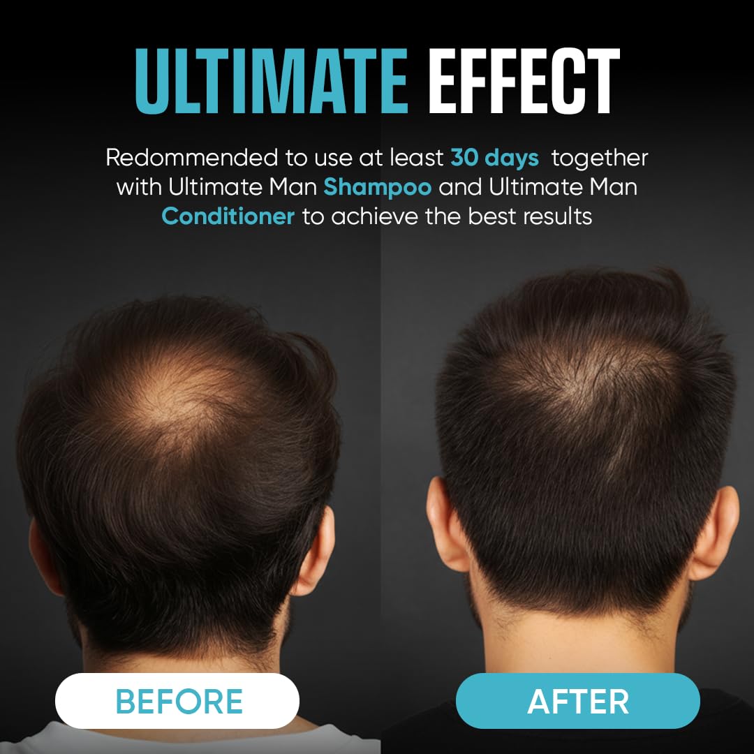 Moerie Ultimate Men Hair Growth Scalp Spray with Biotin and Rosemary