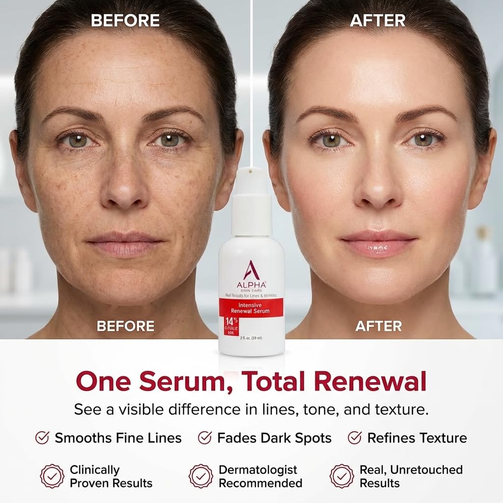 Alpha Skin Care Renewal Serum with 14% Glycolic AHA, 2 Fl Oz