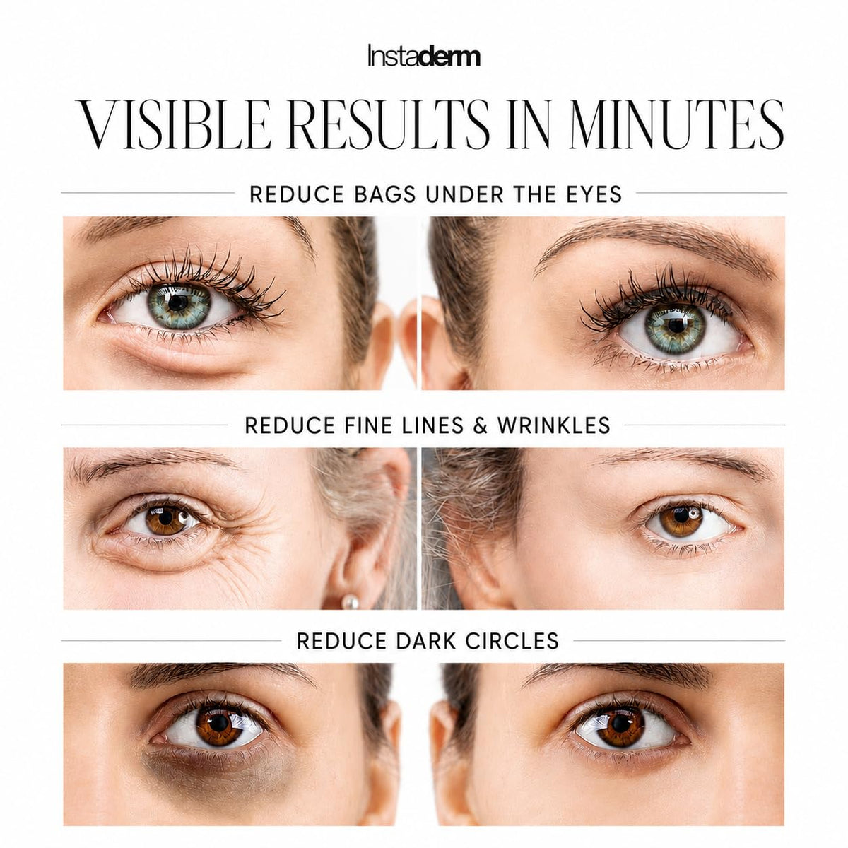 Instaderm Instant Eye Tightener Hydrating Under-Eye Cream