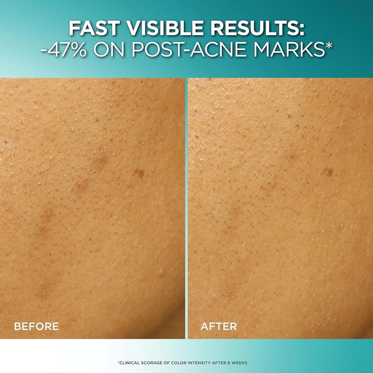 L'Oreal Paris Bright Reveal 25% AHA BHA PHA Dark Spot Exfoliant Peel