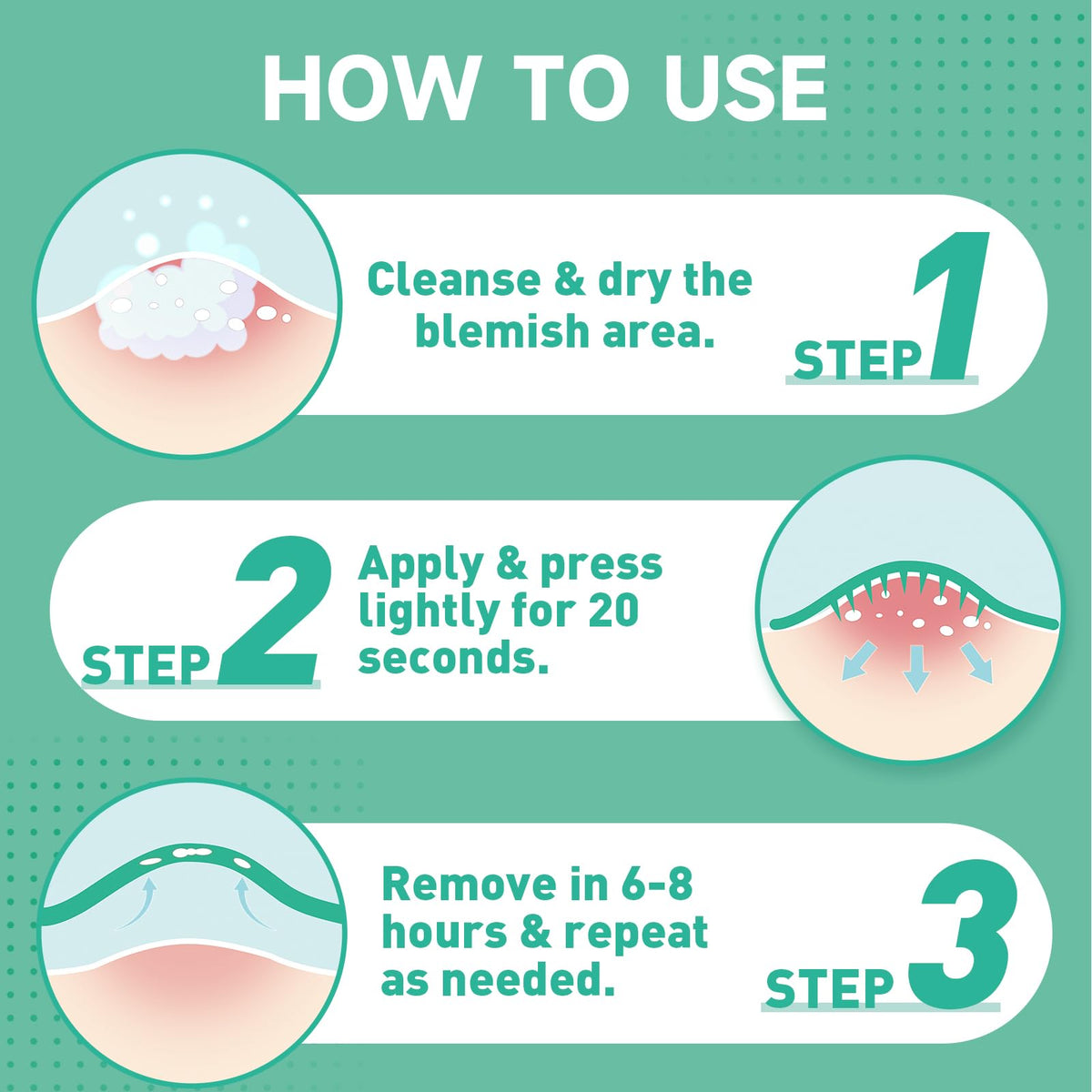 Microdart Pimple Patches
