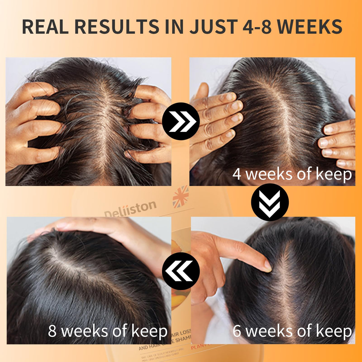 Ginger Anti-Hair Loss Shampoo with Natural Ginger Root Extract