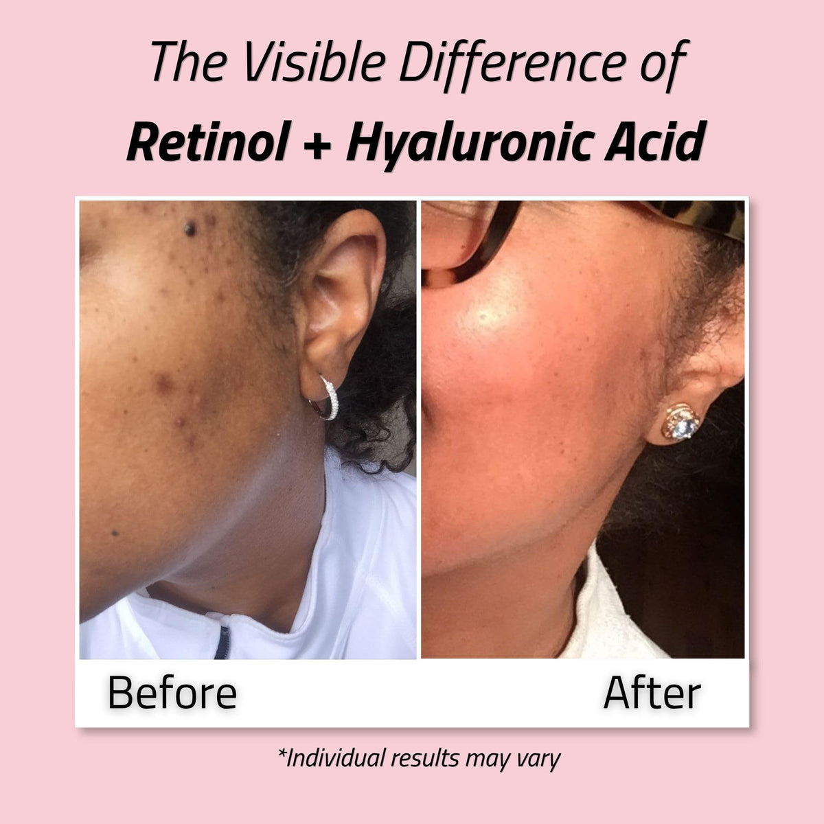 YEOUTH Retinol Face Cream with Hyaluronic Acid