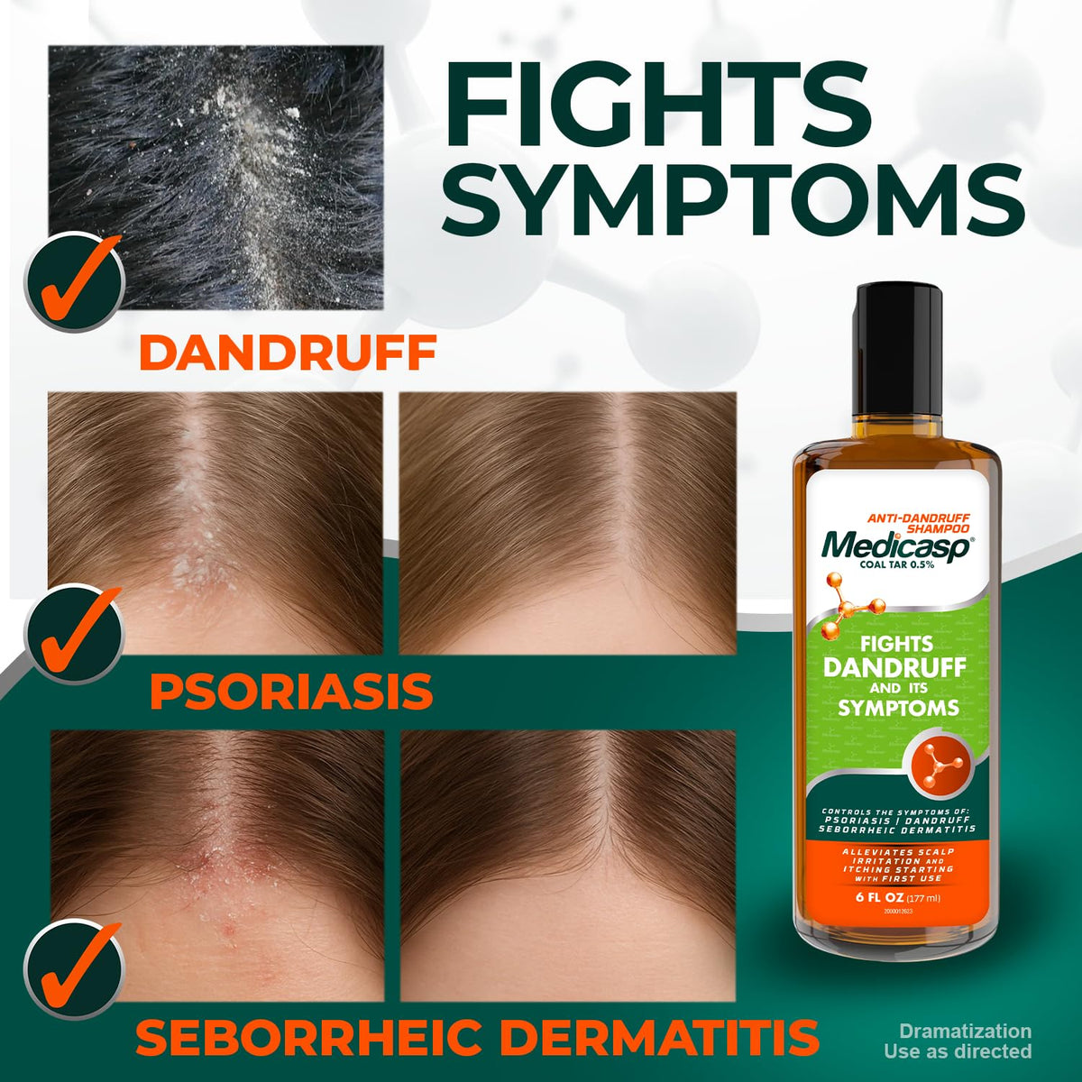 Medicasp Coal Tar Anti-Dandruff Shampoo 0.5%