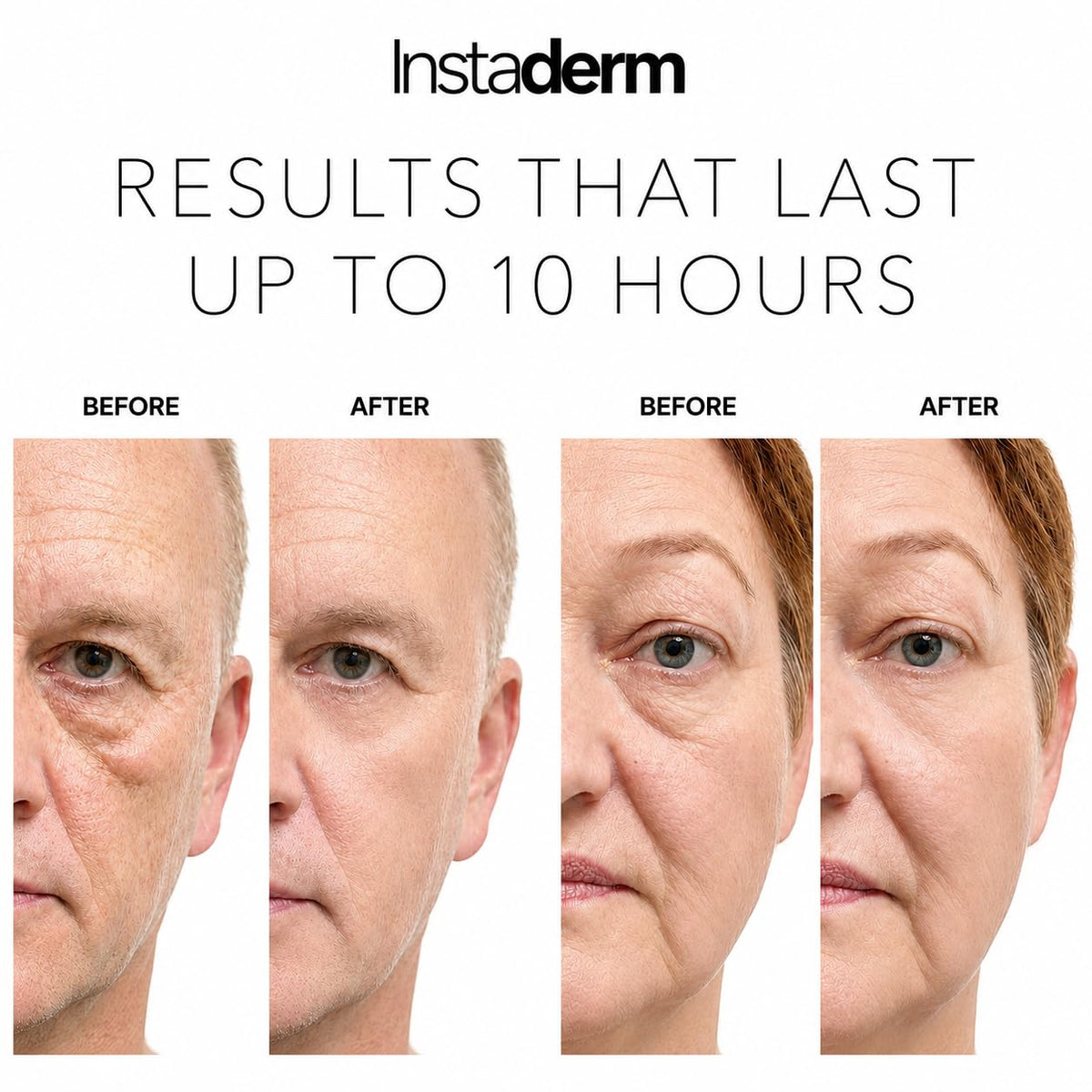 Instaderm Instant Eye Tightener Hydrating Under-Eye Cream