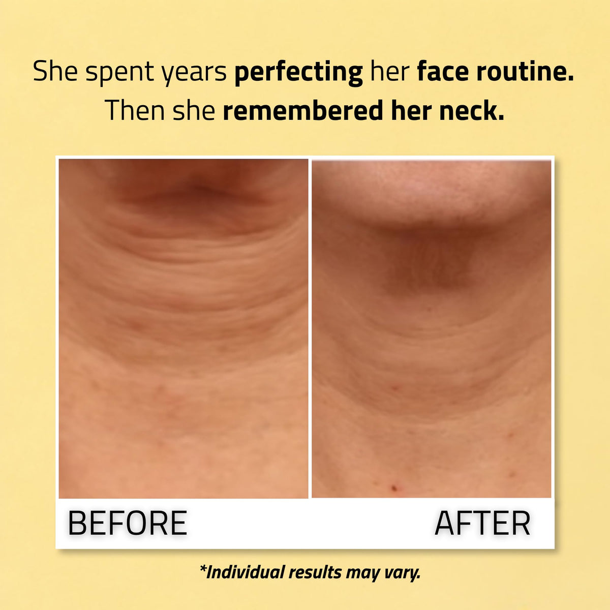 YEOUTH Neck Firming Cream with Vitamin C