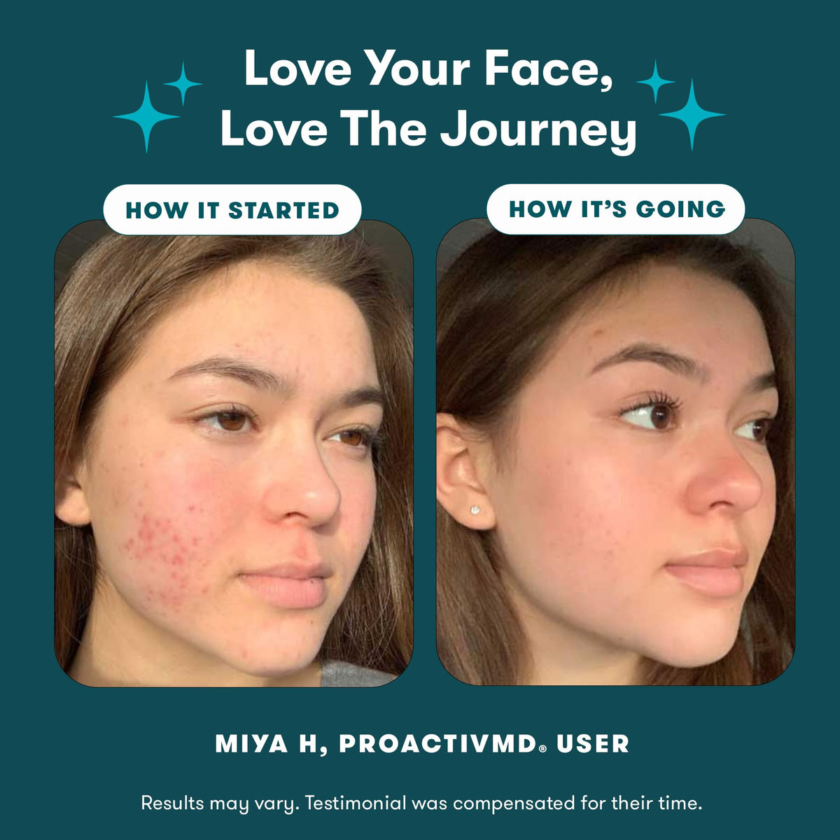 Proactiv MD 3-Step Acne Treatment Kit with Adapalene