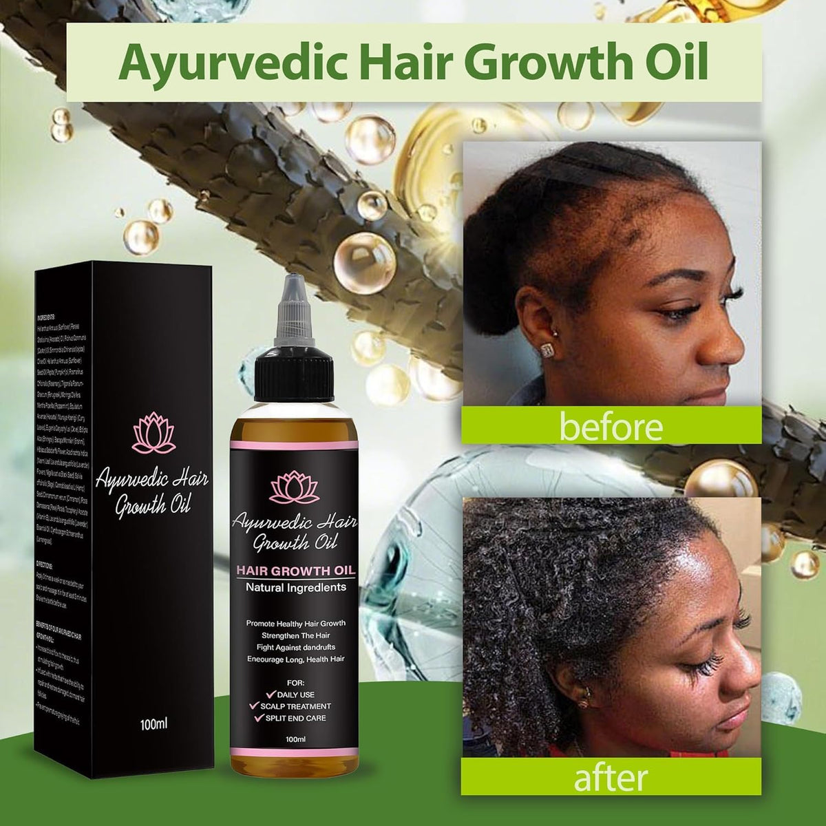 Lifewithqueenp Herbal Hair Growth Oil for Scalp and Hair Care