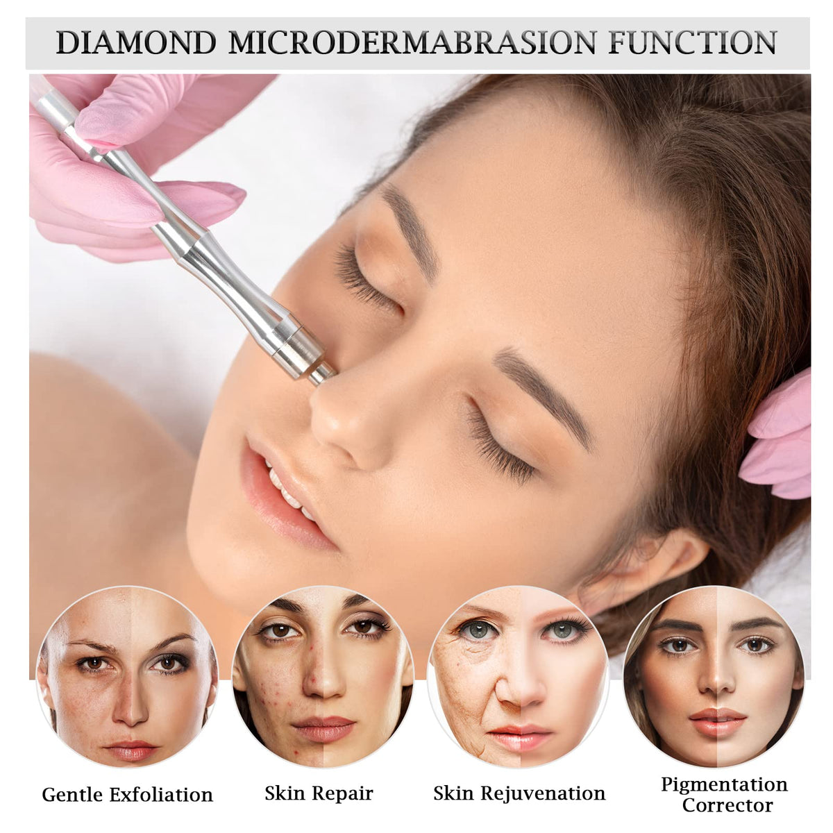 3-in-1 Diamond Microdermabrasion System with Adjustable Vacuum and Spray