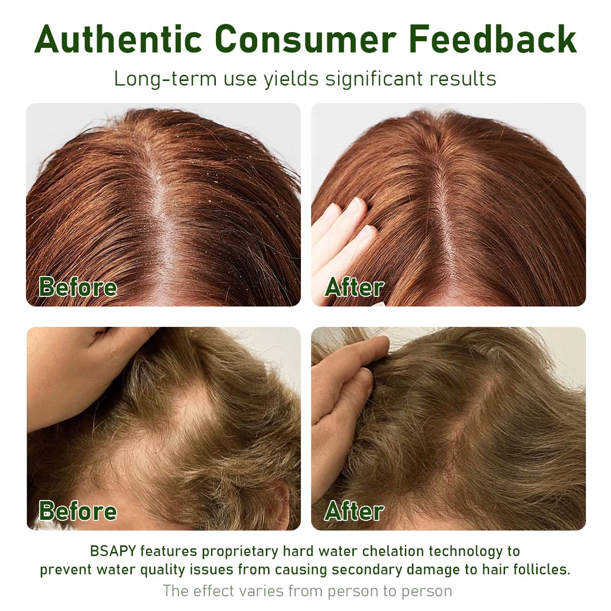 BSAPY Anti Hair Loss Shampoo Bar with Herbal Botanicals, 120g x 2