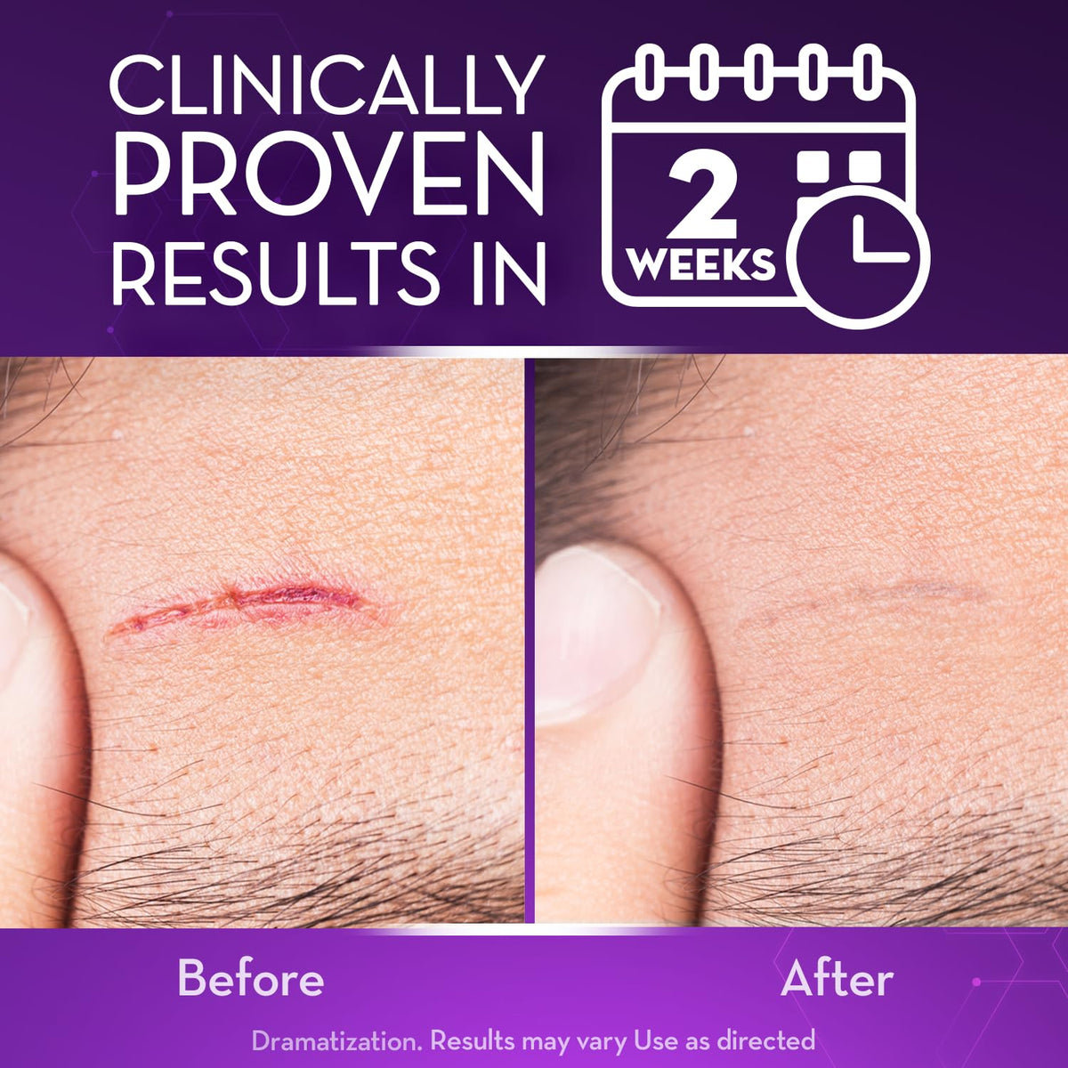 Cicatricure Advanced Scar Gel for Face and Body