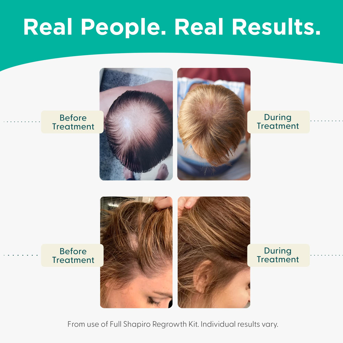 Shapiro MD Hair Growth Experts Hair Loss Shampoo & Leave-In Conditioner