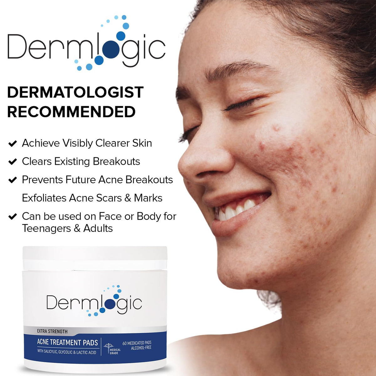 Acne Treatment Pads with Salicylic, Glycolic & Lactic Acid