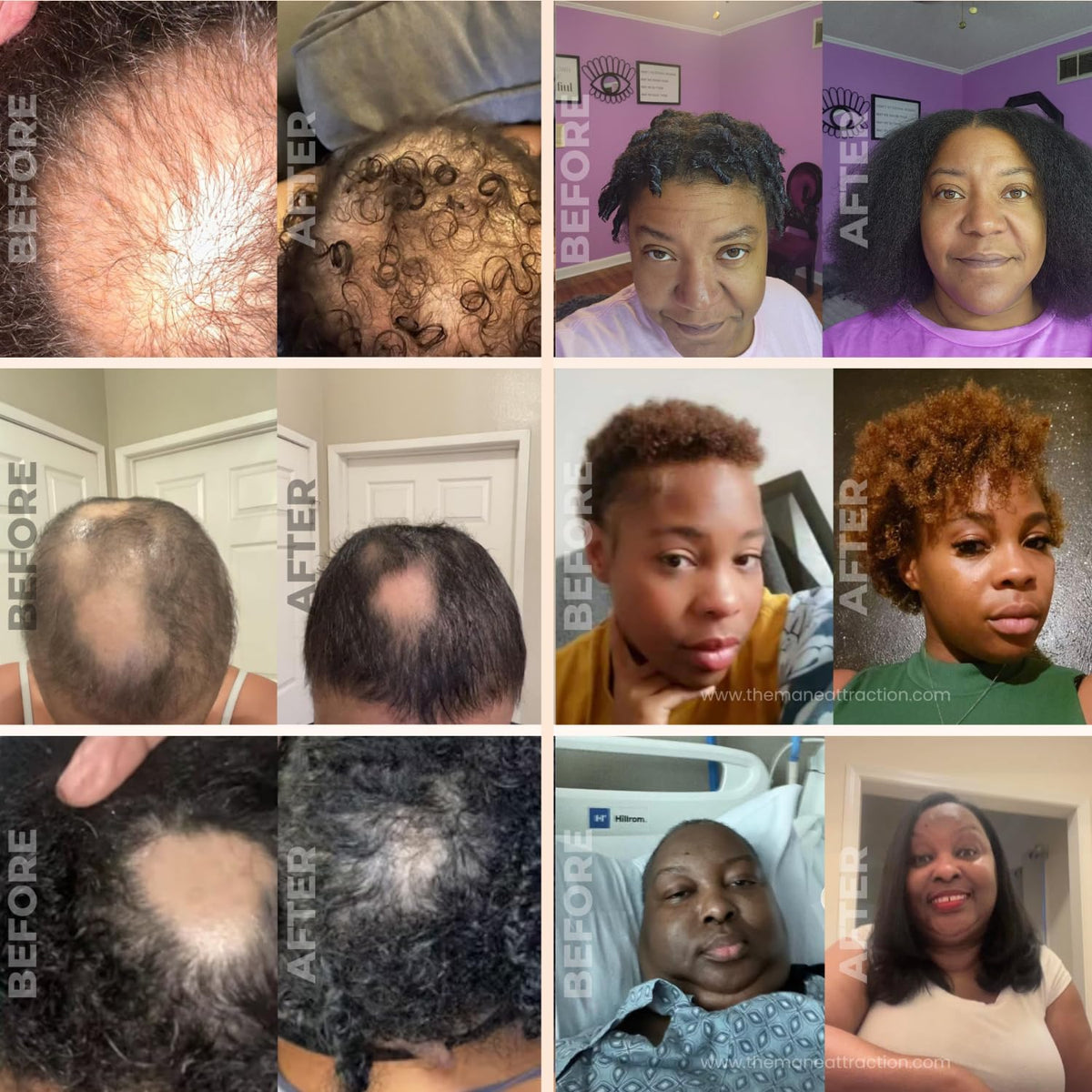 The Mane Attraction Extra-Strength Herbal Hair Growth Oil