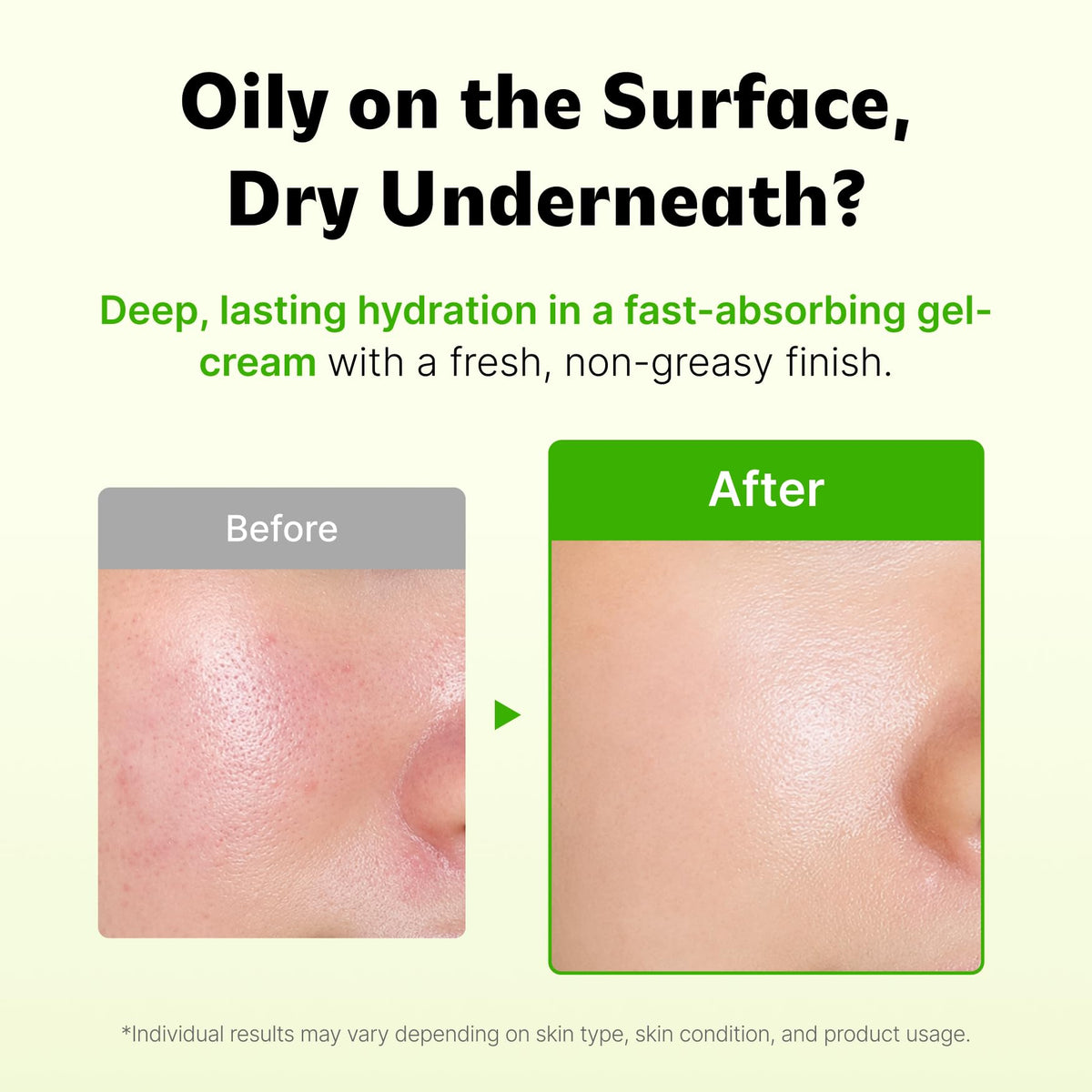 ISOI Dr. Soothing Cream Korean Face Moisturizer with Hyaluronic Acid
