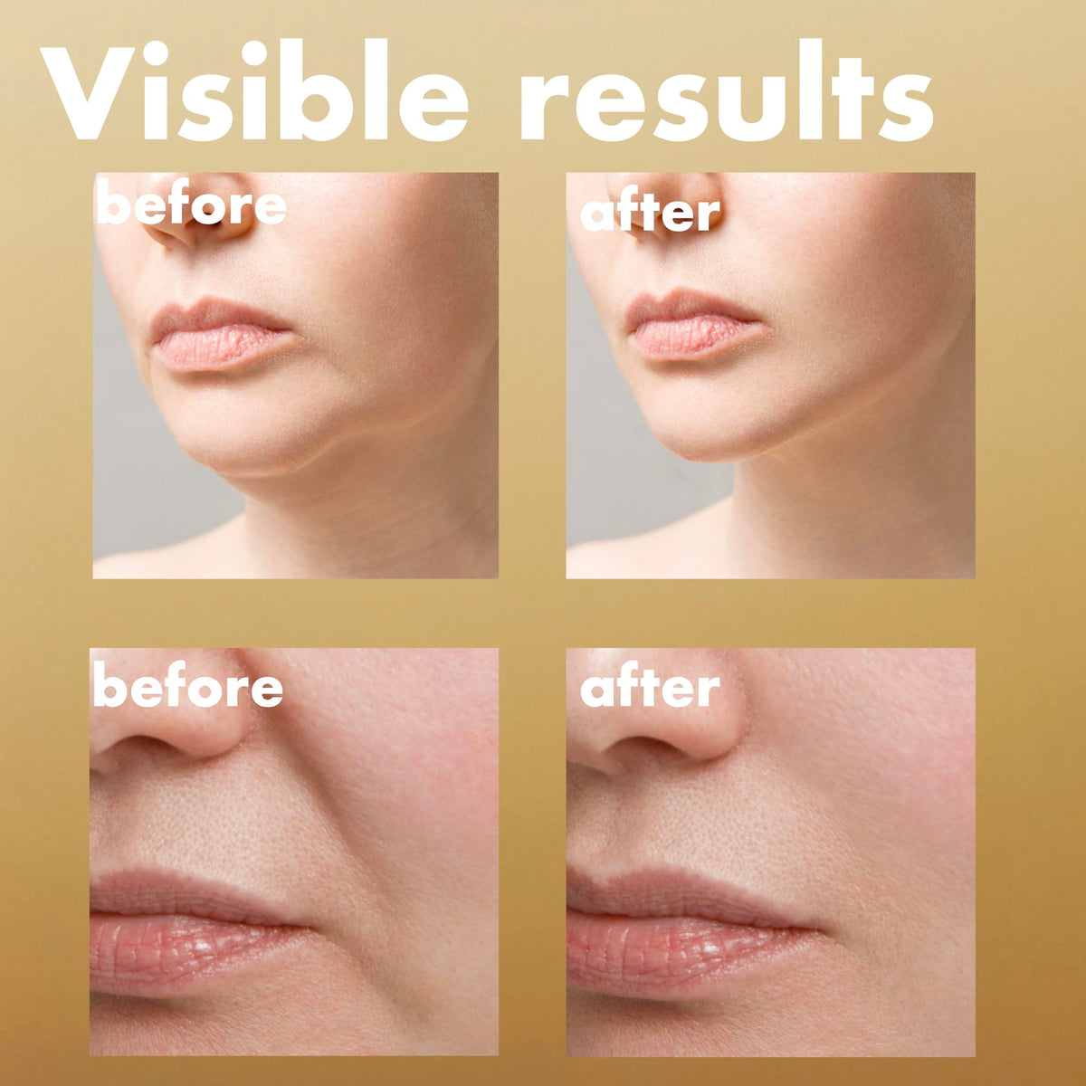ISOI Intensive Lifting Serum, Hydrating Face & Neck Serum, 35ml