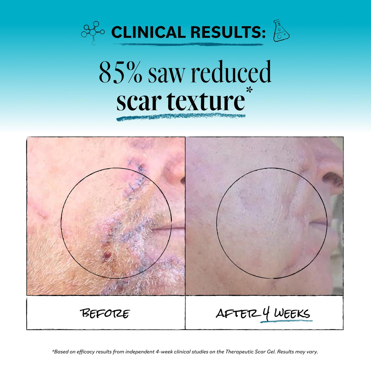 Derma E Scar Gel with Panthenol & Allantoin, 2 oz