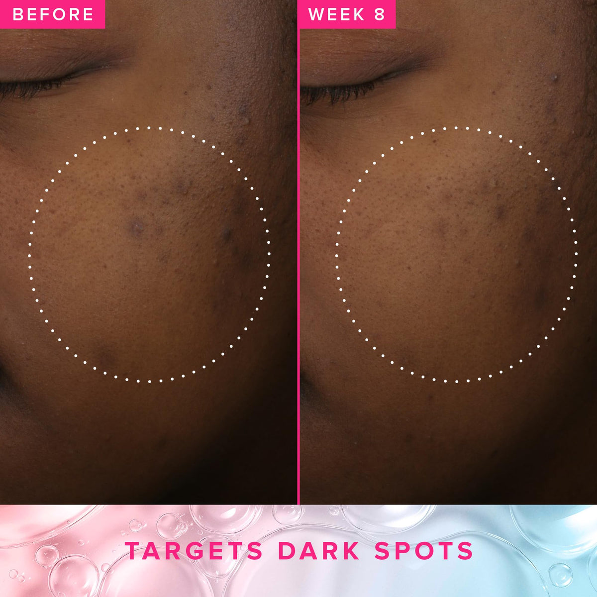 Farmacy Brightening Toner with 3% TXA, Azelaic Acid + 5% PHA