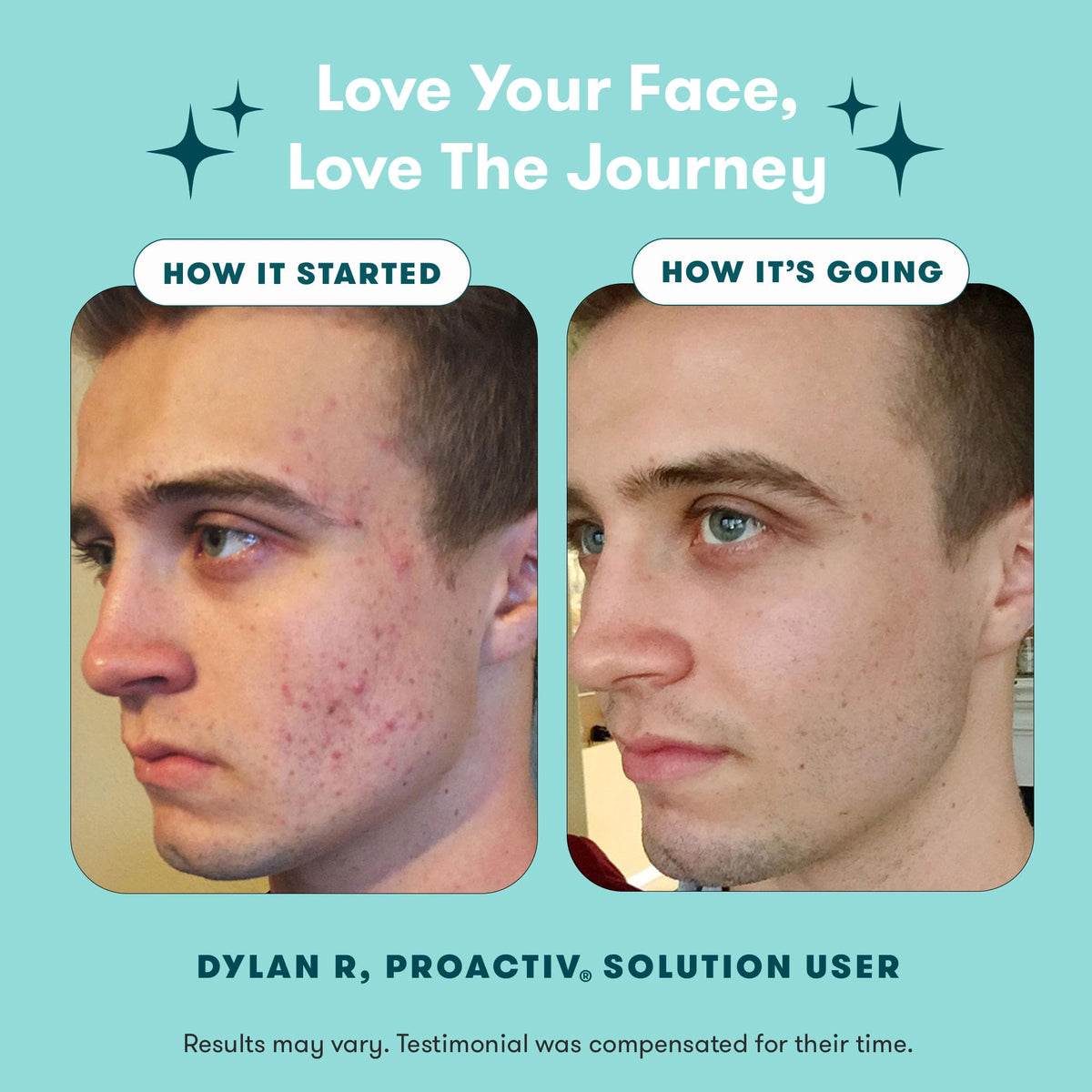 Proactiv 3-Step Acne Treatment System with Benzoyl Peroxide Cleanser