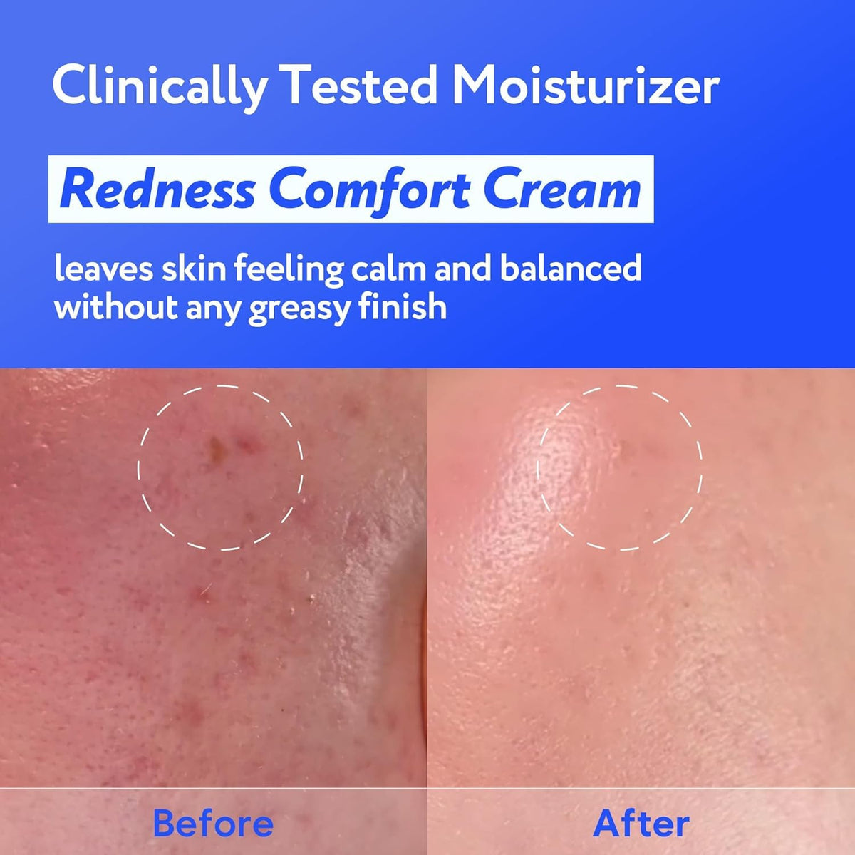Coconut Hydro Barrier Cream with Panthenol, Ceramide & Squalane, 80ml