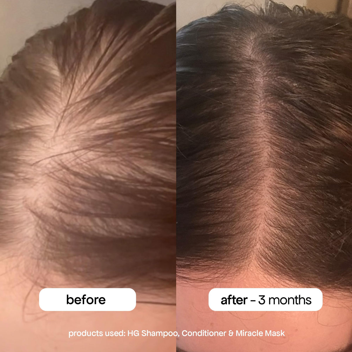 BondiBoost HG Anti-Thinning Shampoo and Conditioner Set