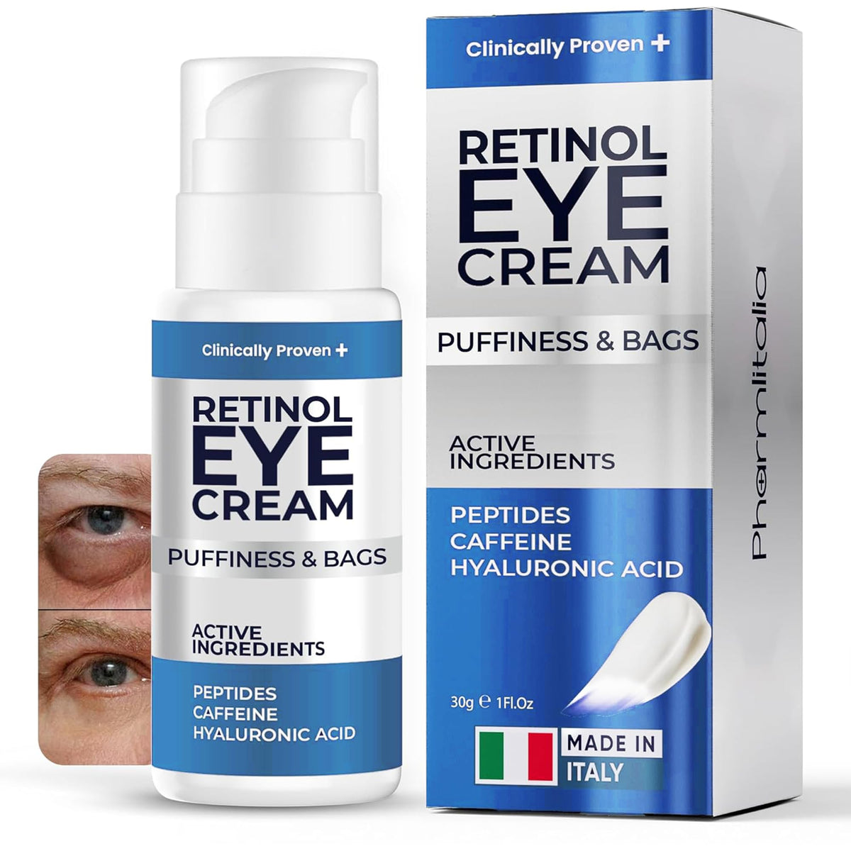 Under Eye Cream with Retinol, Hyaluronic Acid & Caffeine