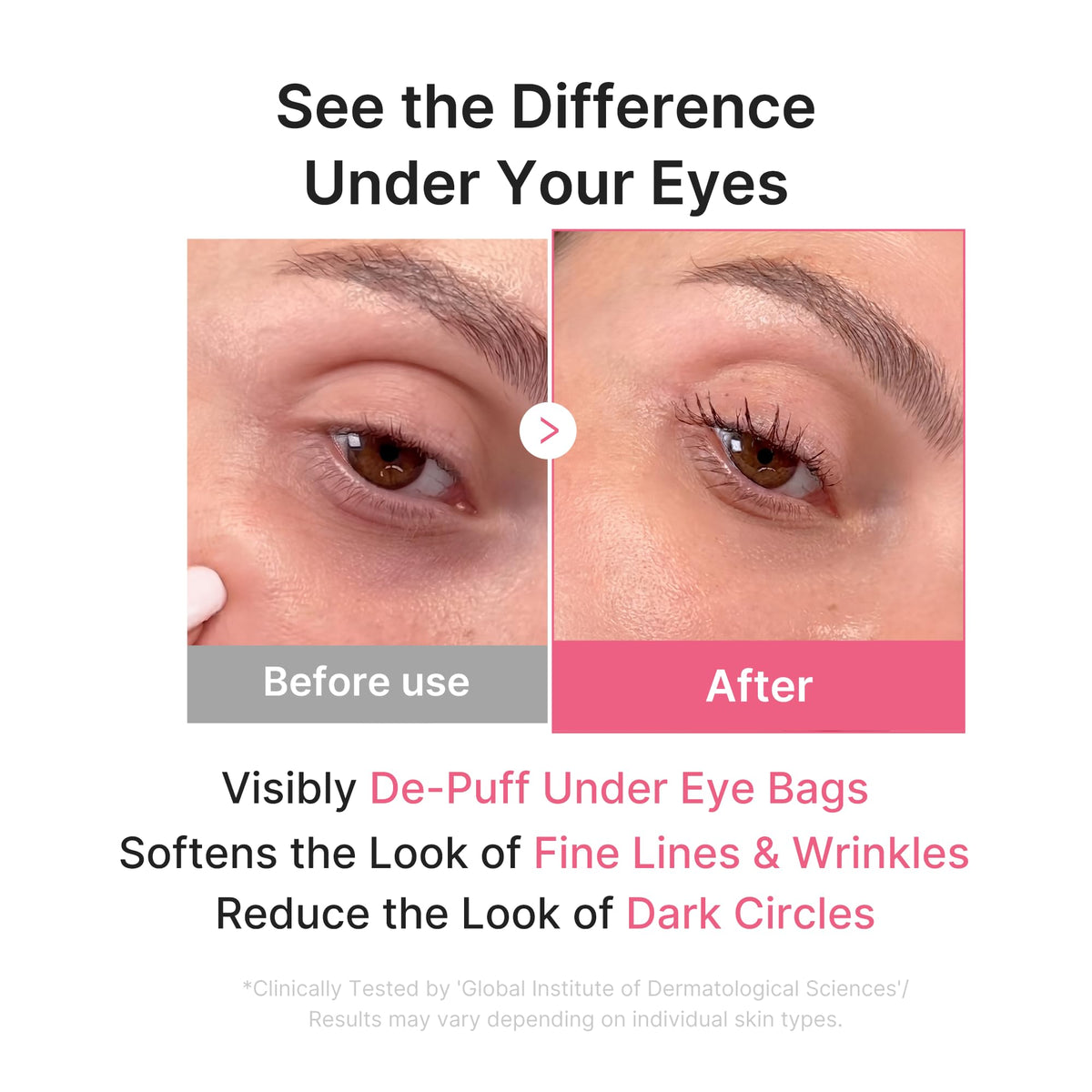 medicube PDRN Pink Collagen Jelly Hydrogel Eye Masks