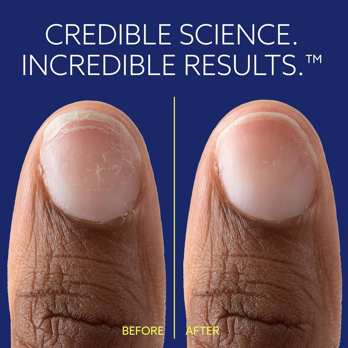 ePhD Bond Repair Nail Treatment for Damaged and Brittle Nails