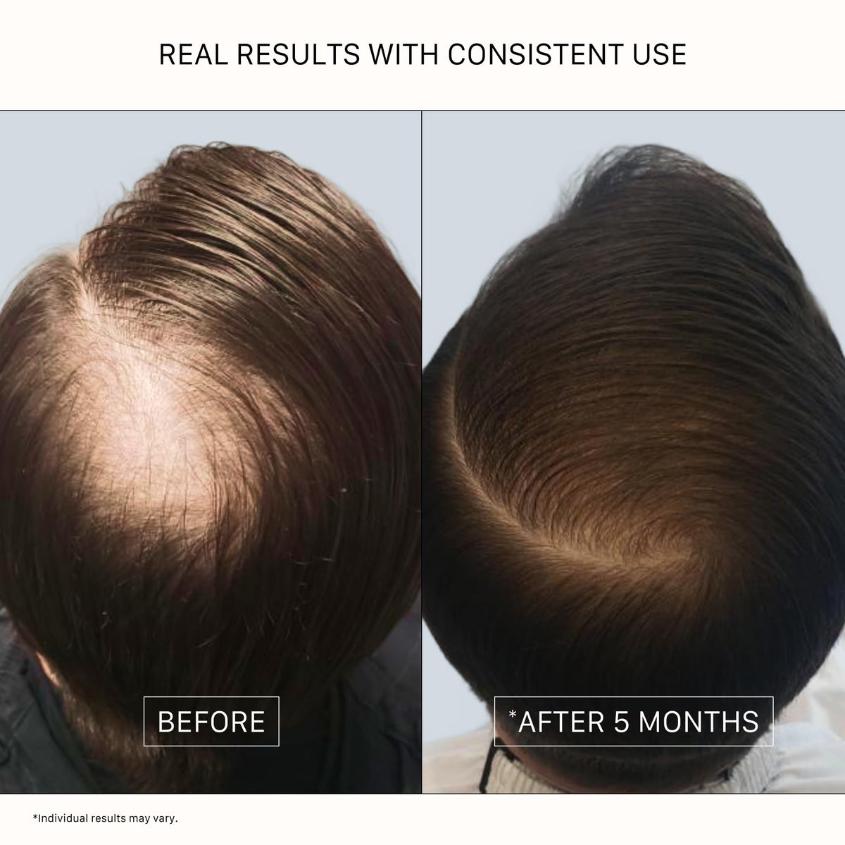 ACTIIV Recover Thickening Shampoo Treatment for Men