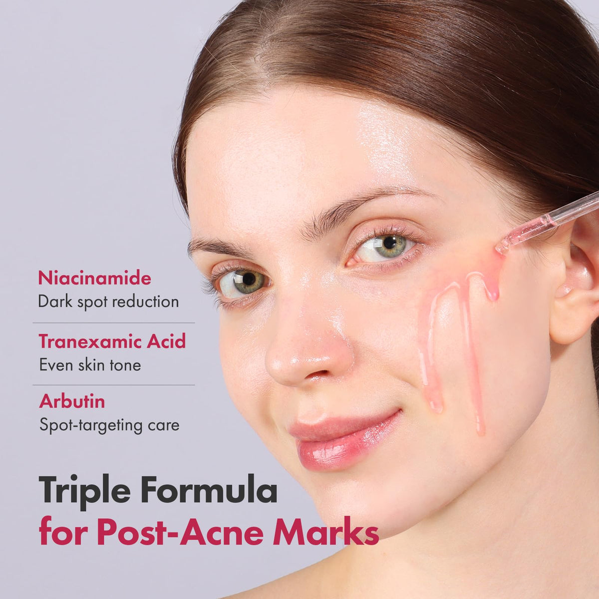 TOSOWOONG Niacinamide 10% + Tranexamic Acid 4% Serum, 33ml
