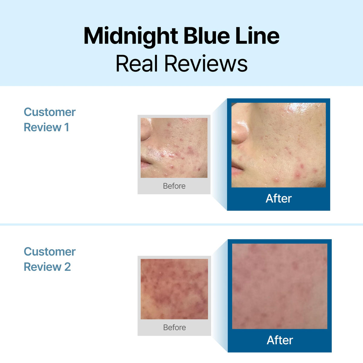 DearKlairs Blue Calming Cream Face Moisturizer for Redness Relief