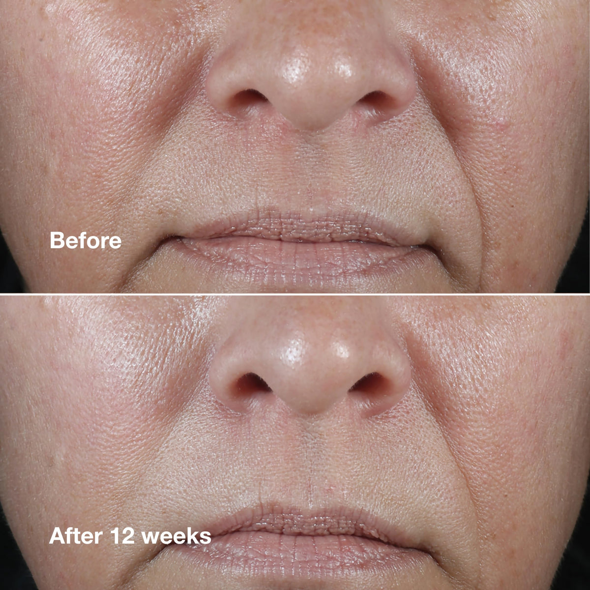 Clinique Smart Clinical Repair Wrinkle Correcting Rich Face Cream