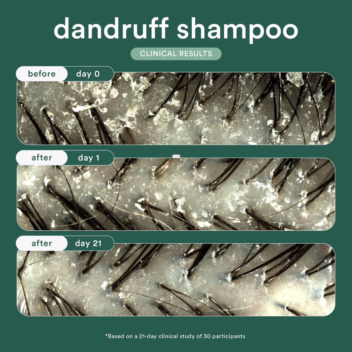 Verb Dandruff Shampoo with 3% Salicylic Acid, Magnolia + Eucalyptus