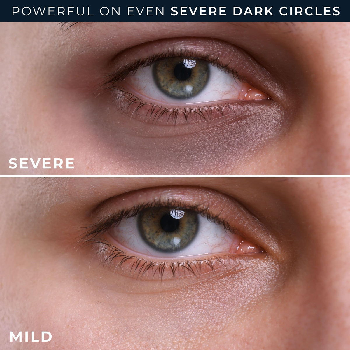 RoC Eye Treatment Cream