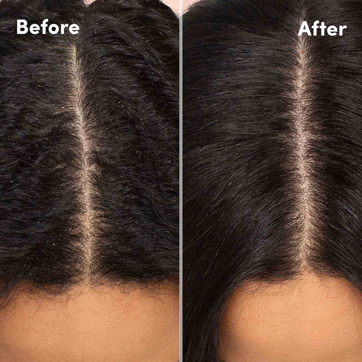 MIZANI Scalp Care Dandruff Shampoo for All Hair Textures