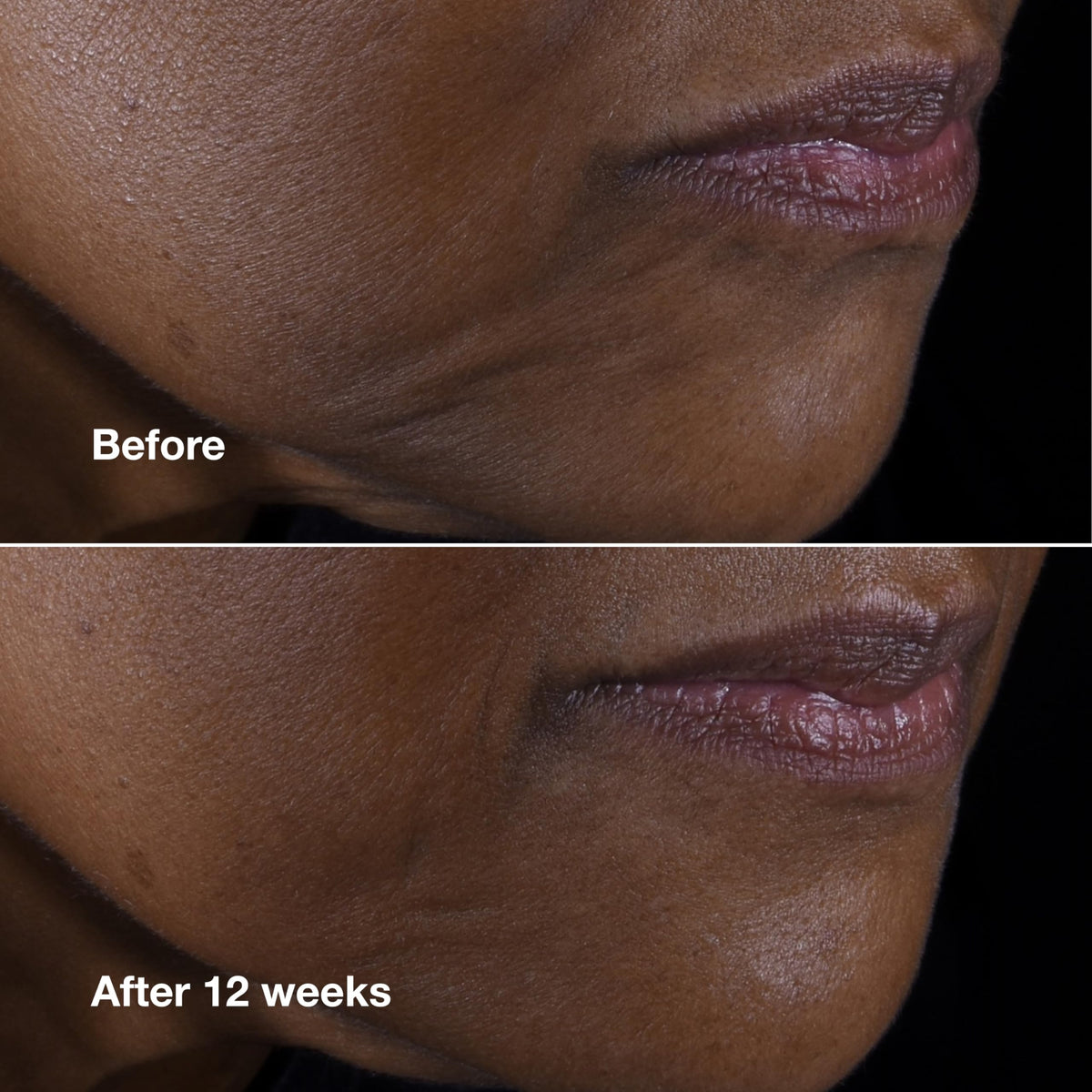 Clinique Smart Clinical Repair Anti-Aging Face & Neck Cream