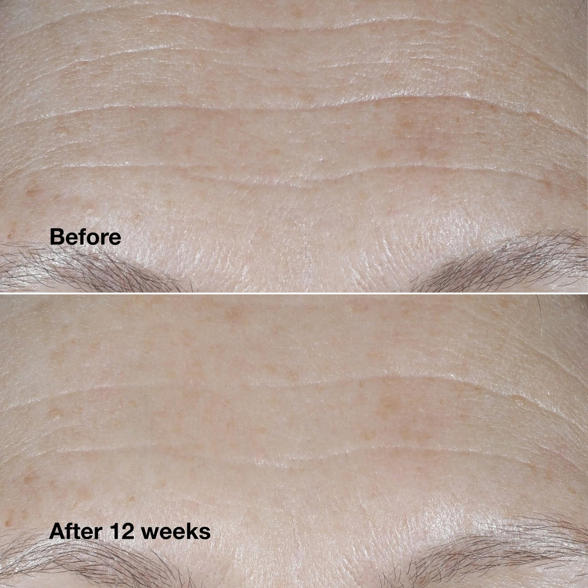 Clinique Smart Clinical Repair Wrinkle Correcting Cream SPF 30