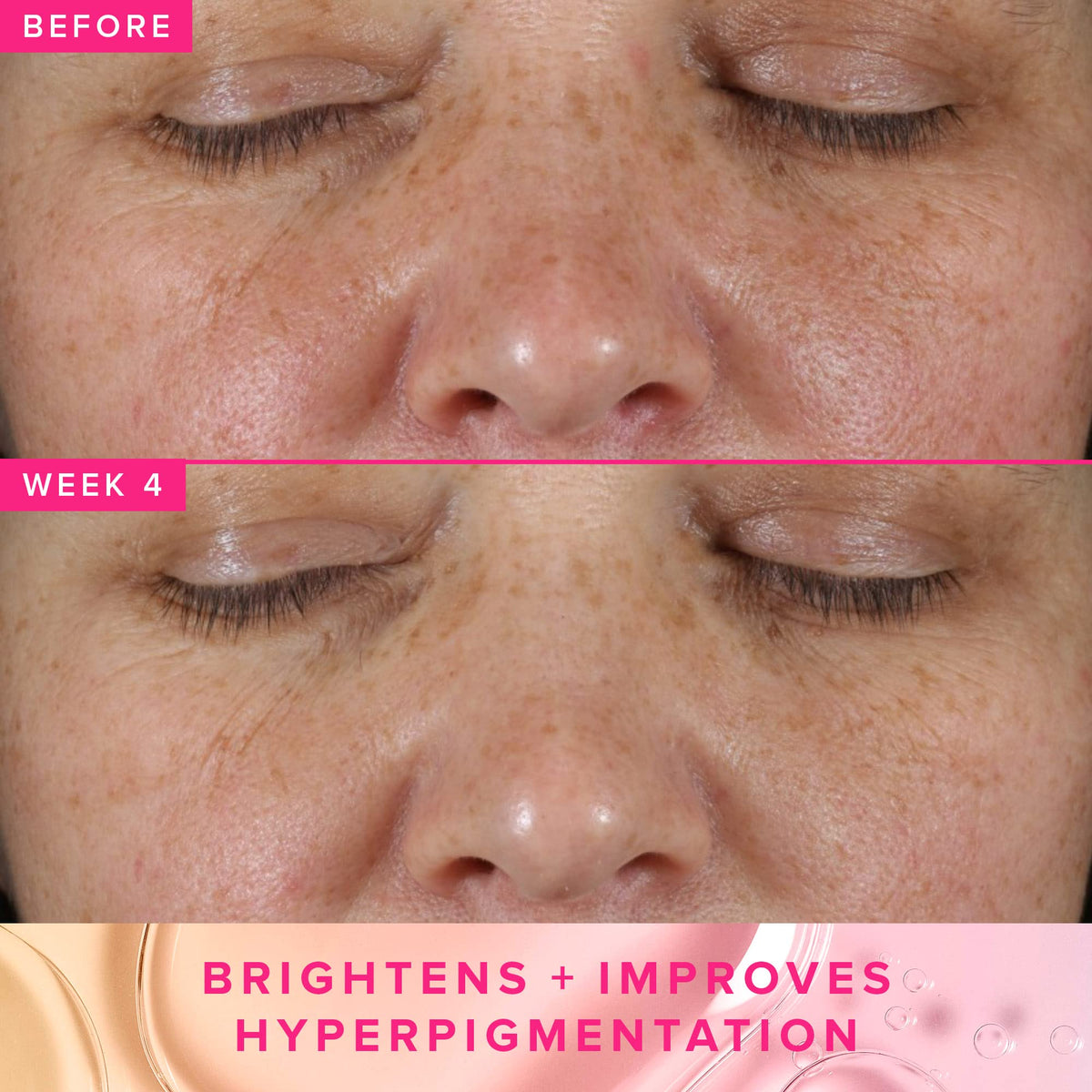 Farmacy Brightening Toner with 3% TXA, Azelaic Acid + 5% PHA