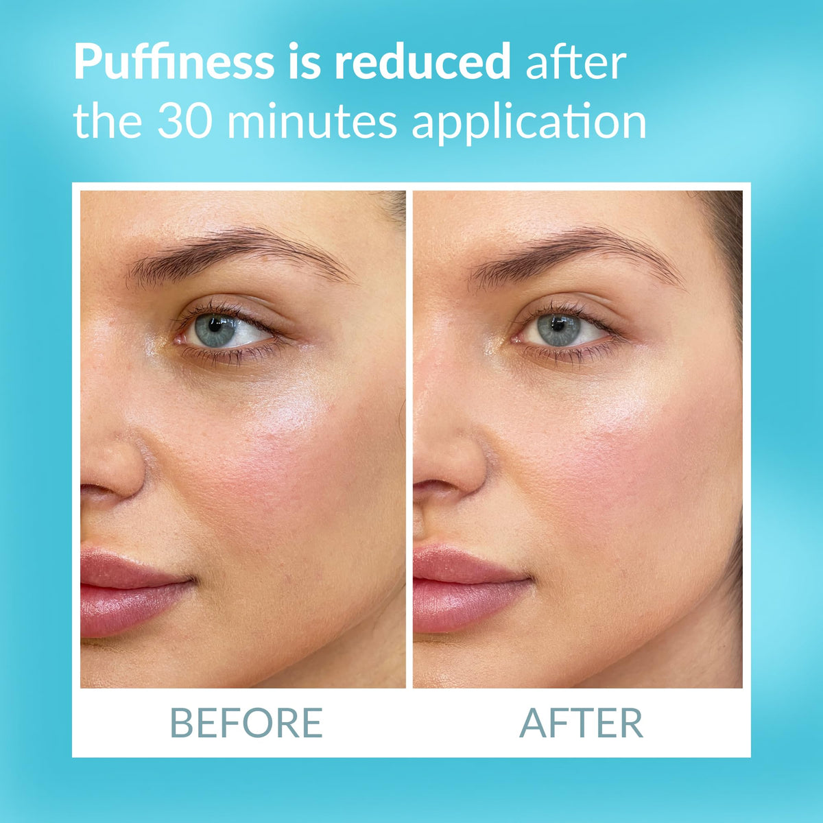 TALIKA Eye Therapy Instant Smoothing Reusable Under-Eye Masks, 6 Pairs with Travel Case