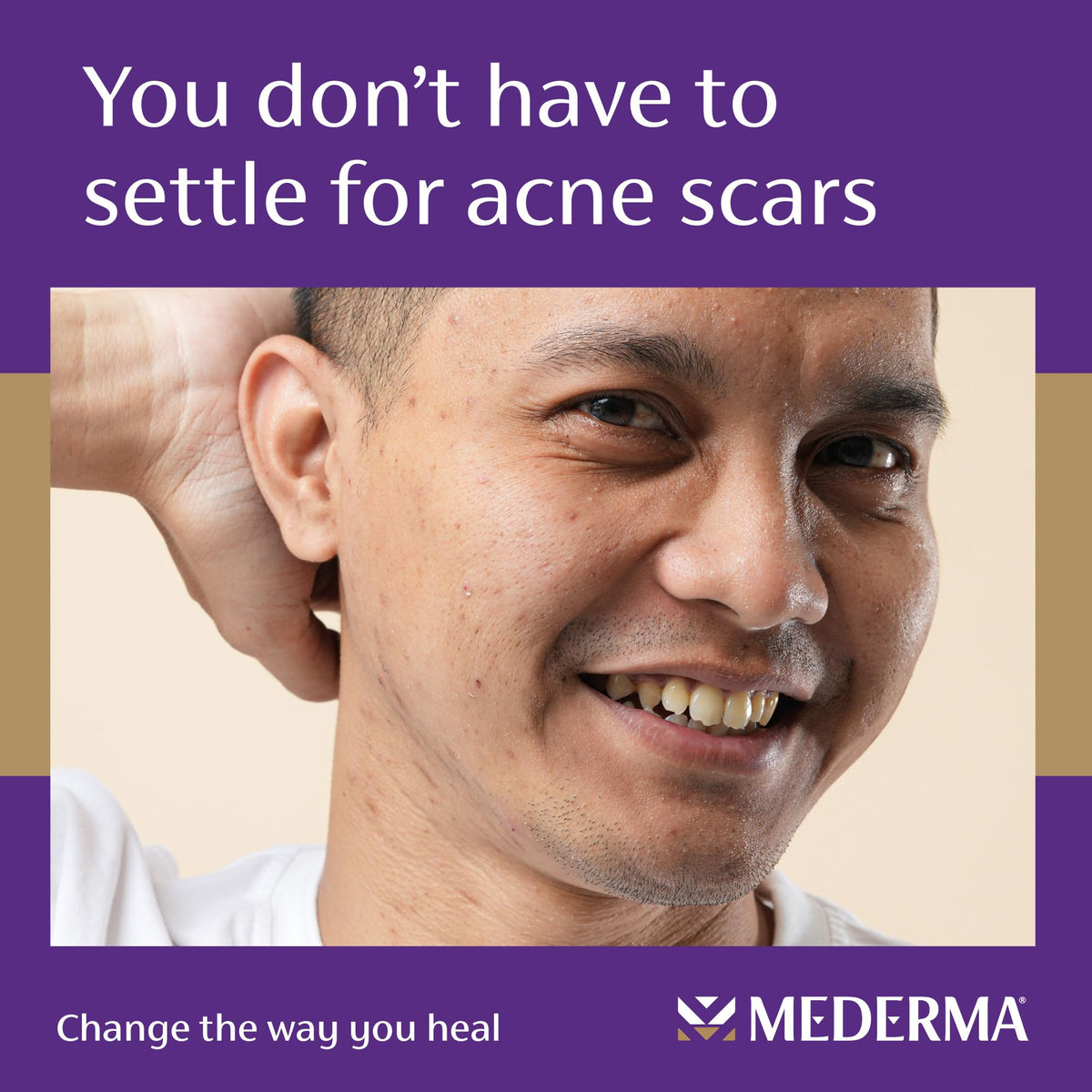 Mederma Acne Scar Serum with Niacinamide, Tetrapeptide-30 and Polyhydroxy Acid