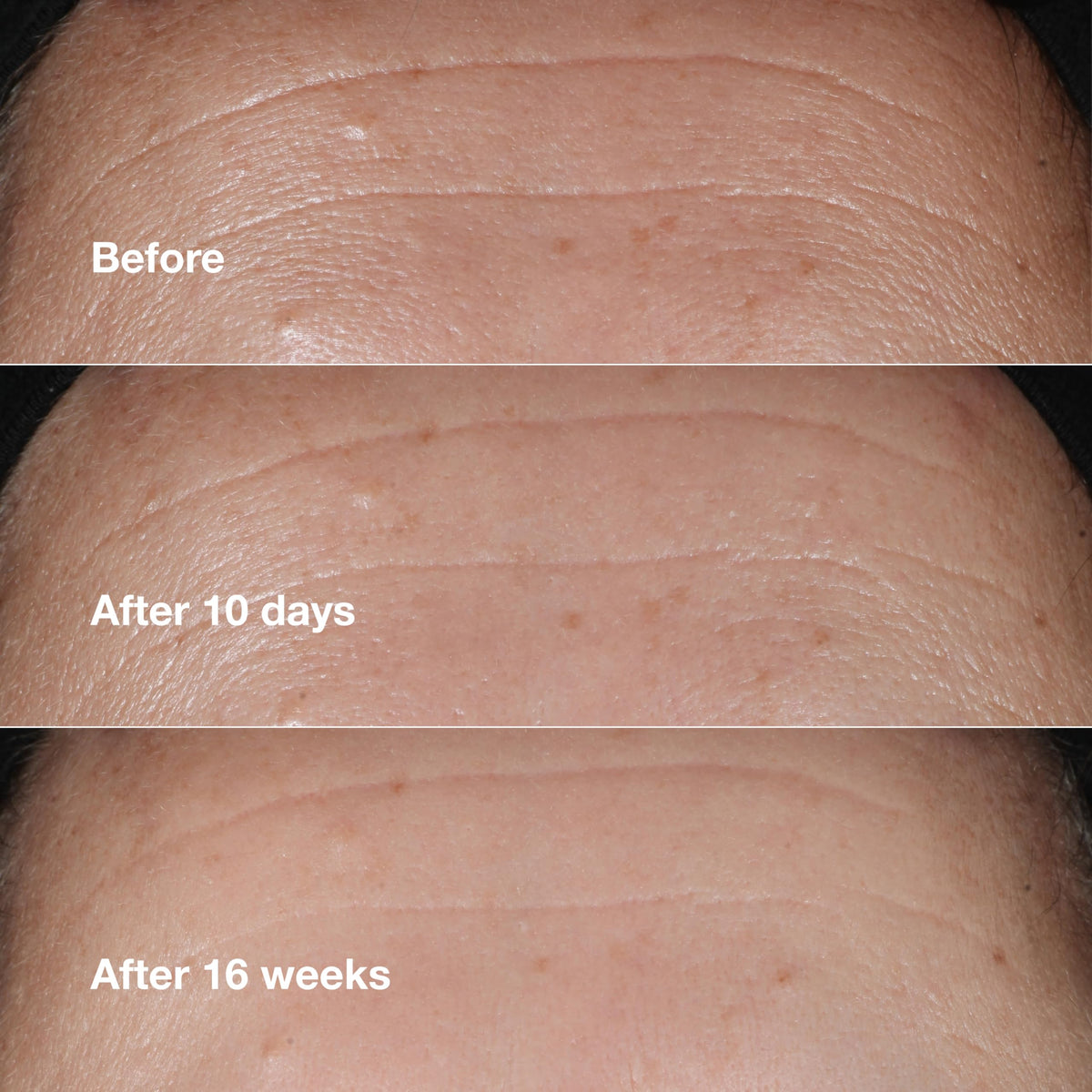 Clinique Smart Clinical Repair Wrinkle Correcting Anti-Aging Face Serum